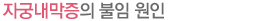 자궁내막증의 불임 원인